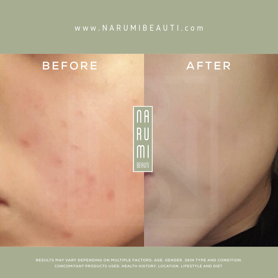 Offer | 2, 35ml Magic Cream