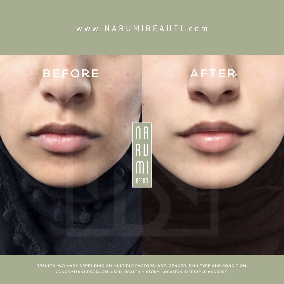 Offer | 2, 35ml Magic Cream