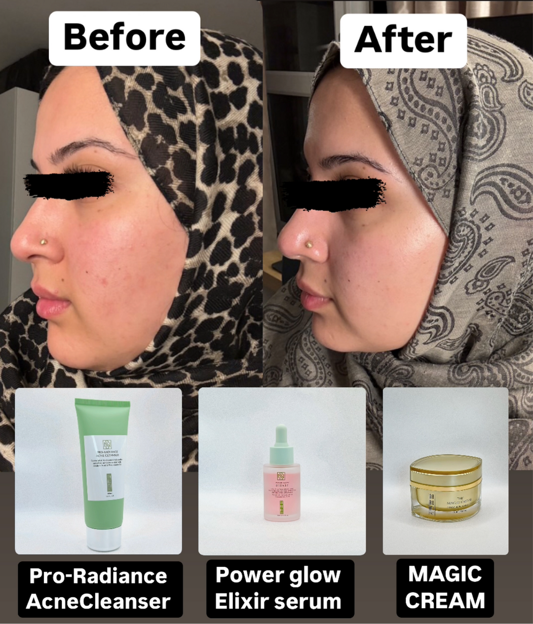 Before and after clear glowing skin 