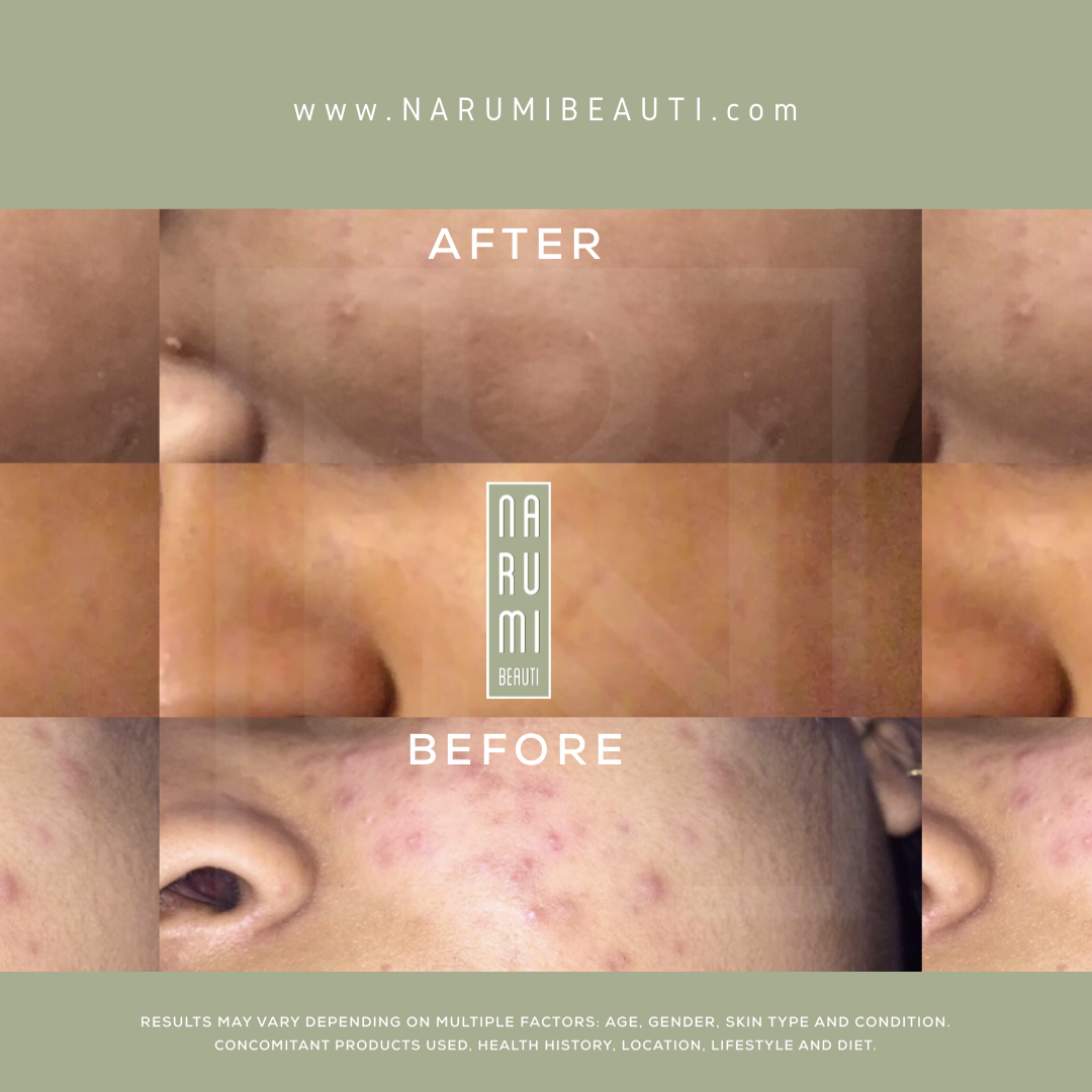 Offer | 2, 35ml Magic Cream